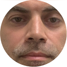 Alton Miftari, CDN, RD, MS, RDN